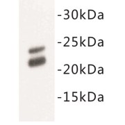 Caveolin 1 (CAV1) Antibody