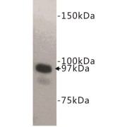 abx019039