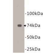 abx019040