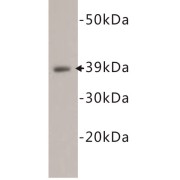 Cluster Of Differentiation 14 (CD14) Antibody