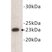 T-Cell Surface Glycoprotein CD3 Epsilon Chain (CD3E) Antibody