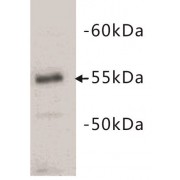 T-Cell Surface Glycoprotein CD4 (CD4) Antibody
