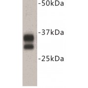 Cluster of Differentiation 8 (CD8) Antibody