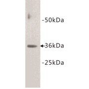 Cyclin D1 (CCND1) Antibody