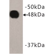 Keratin 18 (KRT18) Antibody