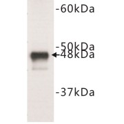 abx019069