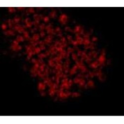 Epithelial Cell Adhesion Molecule (EPCAM) Antibody