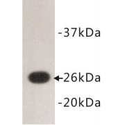 Green Fluorescent Protein (GFP) Antibody