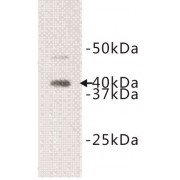 Interleukin 1 Receptor Like Protein 1 (IL1RL1) Antibody