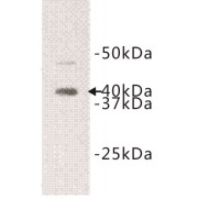 abx019114