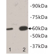 Interleukin 13 Receptor Alpha 1 (IL13RA1) Antibody