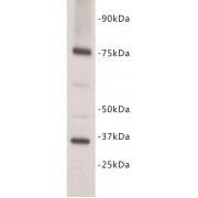 Interleukin 7 Receptor (IL7R) Antibody