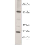 abx019117
