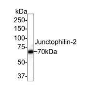 WB analysis of rat skeletal muscle tissue, using JPH2 antibody  (1/500 dilution). Calculated molecular weight: 74 kDa, observed molecular weight: 70 kDa.