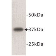 L-Lactate Dehydrogenase A Chain (LDH-A) Antibody