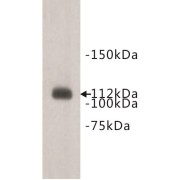 Meckelin (TMEM67) Antibody
