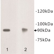 Netrin Receptor DCC (DCC) Antibody