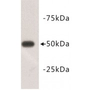 Tubulin Beta 3 (TUBB3) Antibody