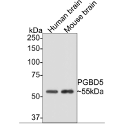 Western blot analysis of Human and Mouse Brain tissue lysates, using PiggyBac Transposable Element Derived 5 Antibody.