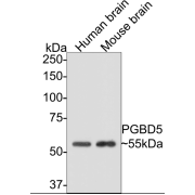 Western blot analysis of Human and Mouse Brain tissue lysates, using PiggyBac Transposable Element Derived 5 Antibody.