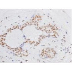 Polycomb Complex Protein BMI-1 (BMI1) Antibody