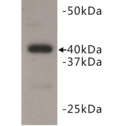 Polycomb Complex Protein BMI-1 (BMI1) Antibody