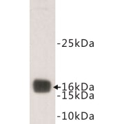 Transthyretin (TTR) Antibody