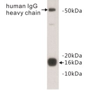 Transthyretin (TTR) Antibody