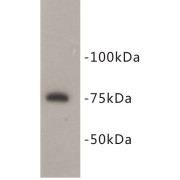 Protein Arginine N-Methyltransferase 5 (PRMT5) Antibody