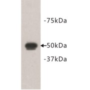 Protocadherin Fat 1 Antibody
