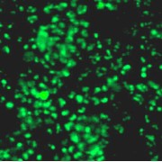 Transcription Factor SOX-2 (SOX2) Antibody