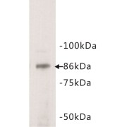 Signal Transducer And Activator of Transcription 3 (STAT3) Antibody