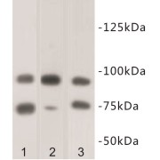 Polycomb Protein SUZ12 (SUZ12) Antibody