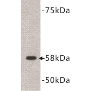 Terminal Deoxyribonucleotidyltransferase (DNTT) Antibody