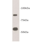 Cell Surface Hyaluronidase (CEMIP2) Antibody