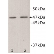 Transmembrane Protein 200A (TMEM200A) Antibody