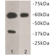 Transmembrane Protein 57 (TMEM57) Antibody