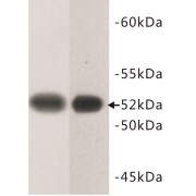 Tubulin Beta (TUBB) Antibody