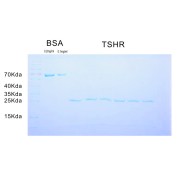 SDS-PAGE analysis of TSHR protein.