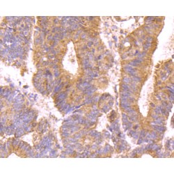 Mucin 4 (MUC4) Antibody