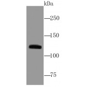 WB analysis of PC-3M cells using MUC4 antibody (1/1000 dilution).