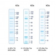 The Protein Ladder patterns in various electrophoresis conditions.